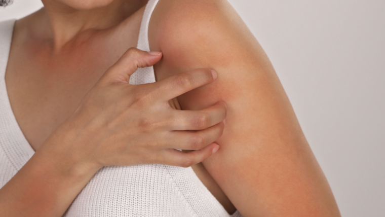 Dermatologist Appointment for Severe Itching and Inflamed Skin in McLean, Virginia